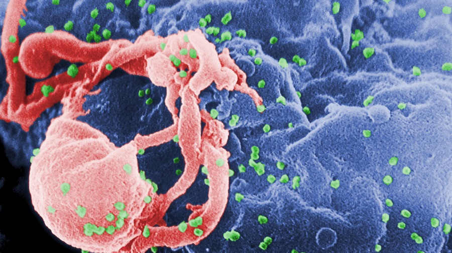HIV-budding-Color